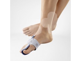 HALLUX VALGUS DERECHO T.1 VALGULOC HALLUX VALGUS DERECHO T.1 VALGULOC